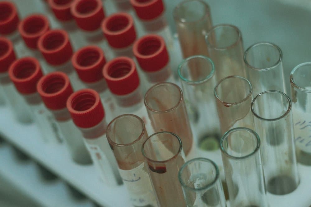 Sample tubes in a laboratory